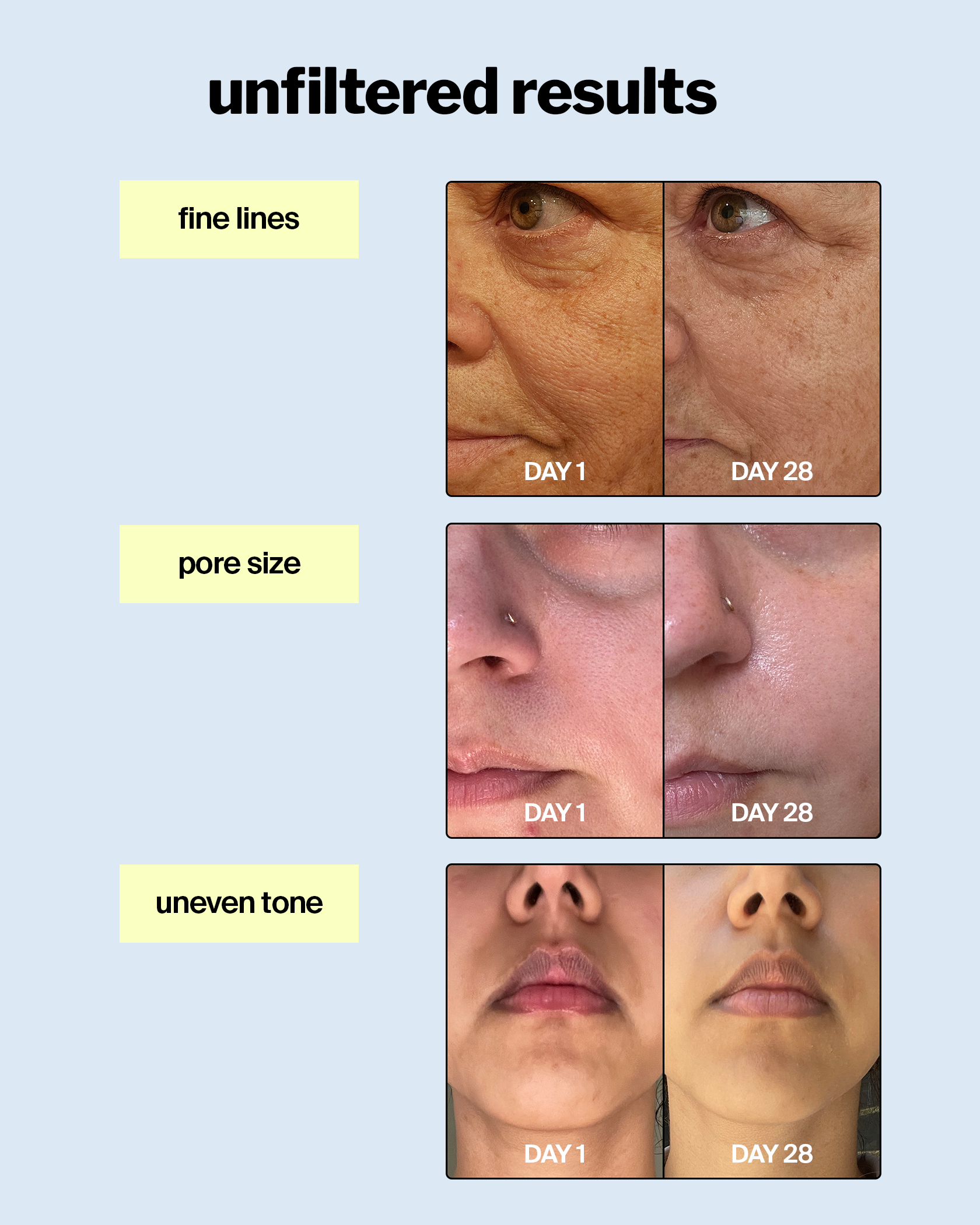 advanced-retinol-gel-pdp-before-after.png