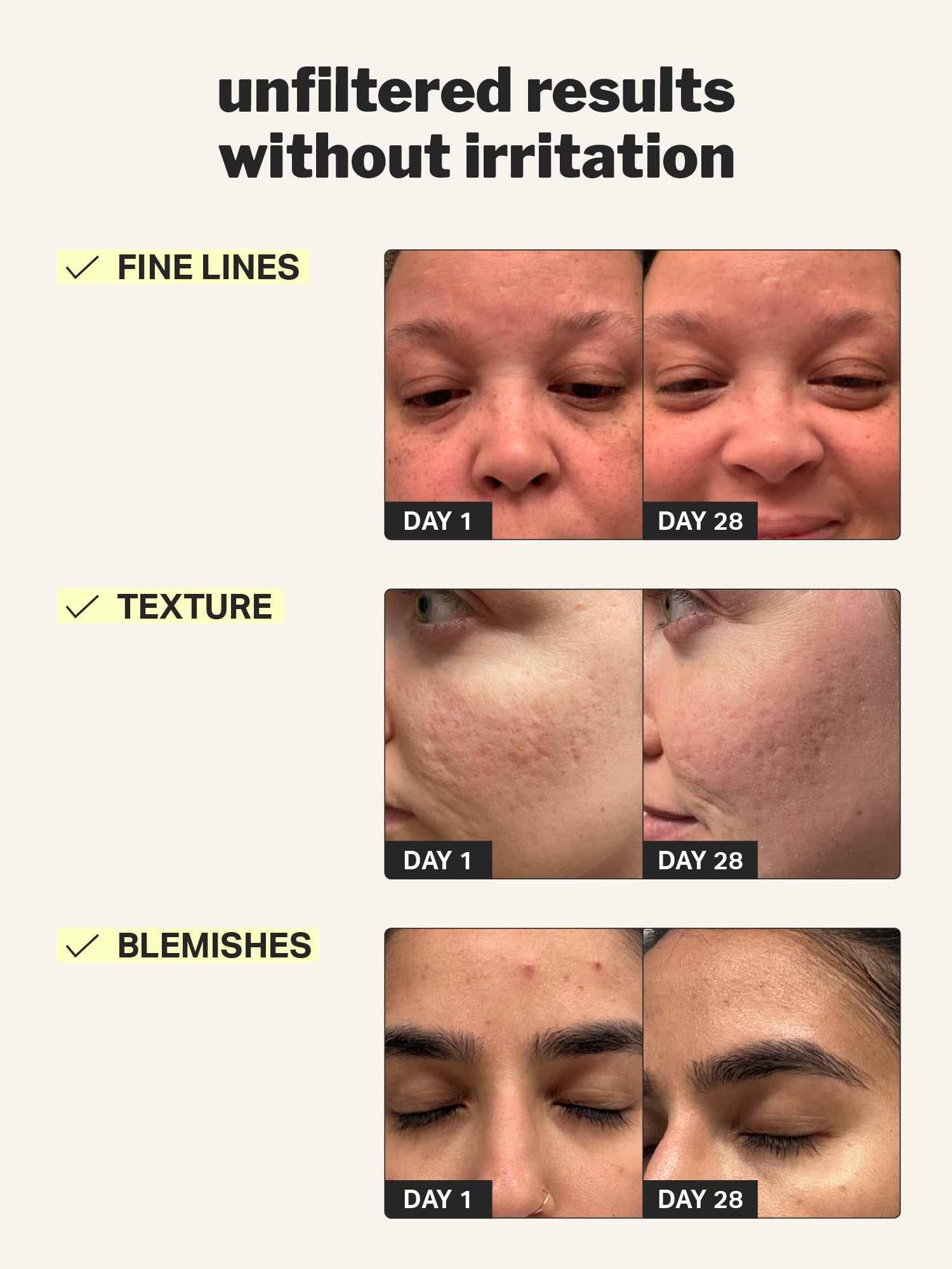 beginner-retinol-gel-01-771564.jpg